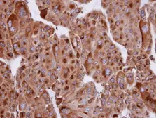 Anti-SERTAD1 antibody [N1N2], N-term used in IHC (Paraffin sections) (IHC-P). GTX106457