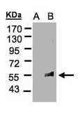 Anti-FLVCR antibody [C3], C-term used in Western Blot (WB). GTX106462