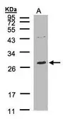 Anti-NTAL antibody [C2C3], C-term used in Western Blot (WB). GTX106463