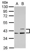 Anti-Apolipoprotein L1 antibody used in Western Blot (WB). GTX106472
