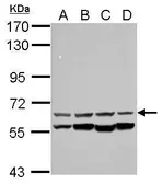 Anti-CESK1 antibody used in Western Blot (WB). GTX106479