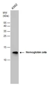 Anti-Hemoglobin zeta antibody [N1C3] used in Western Blot (WB). GTX106483