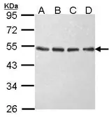 Anti-EIF2 beta antibody used in Western Blot (WB). GTX106484