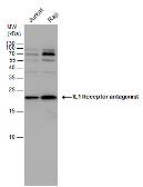 Anti-IL1 Receptor antagonist antibody used in Western Blot (WB). GTX106490