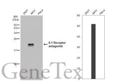 Anti-IL1 Receptor antagonist antibody used in Western Blot (WB). GTX106490