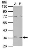 Anti-GGPS1 antibody used in Western Blot (WB). GTX106493