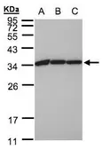 Anti-EEF1B2 antibody [N1C3] used in Western Blot (WB). GTX106535