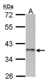 Anti-Cyclin I2 antibody [N3C3] used in Western Blot (WB). GTX106554