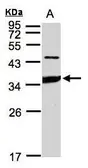 Anti-ICAM2 antibody [N1C2] used in Western Blot (WB). GTX106555