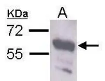Anti-Staufen antibody used in Western Blot (WB). GTX106566