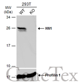 Anti-HN1 antibody used in Western Blot (WB). GTX106585
