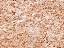 Anti-AKR7A3 antibody [N3C3] used in IHC (Paraffin sections) (IHC-P). GTX106613