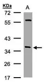 Anti-alpha SNAP antibody [N2C3] used in Western Blot (WB). GTX106626