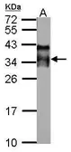 Anti-Acrosomal vesicle protein antibody used in Western Blot (WB). GTX106643