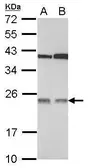 Anti-TMED7 antibody [N1C3] used in Western Blot (WB). GTX106658