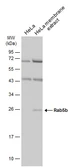 Anti-Rab5b antibody used in Western Blot (WB). GTX106661