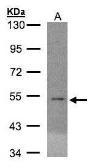 Anti-EIF5 antibody [N1N3] used in Western Blot (WB). GTX106663