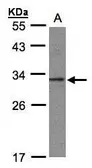Anti-C20orf11 antibody [N1C3] used in Western Blot (WB). GTX106672