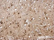 Anti-SKP1 antibody used in IHC (Paraffin sections) (IHC-P). GTX106675