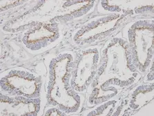 Anti-YIPF4 antibody [N1C2] used in IHC (Paraffin sections) (IHC-P). GTX106680