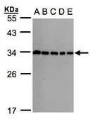 Anti-CHMP5 antibody [N1C3] used in Western Blot (WB). GTX106692
