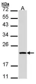 Anti-Diablo antibody [N1C3] used in Western Blot (WB). GTX106746