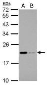 Anti-Apolipoprotein M antibody used in Western Blot (WB). GTX106750