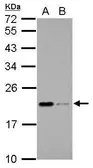 Anti-Apolipoprotein M antibody used in Western Blot (WB). GTX106750