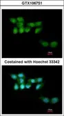 Anti-UVSSA antibody [N1N2], N-term used in Immunocytochemistry/ Immunofluorescence (ICC/IF). GTX106751