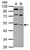 Anti-LYCAT antibody used in Western Blot (WB). GTX106759