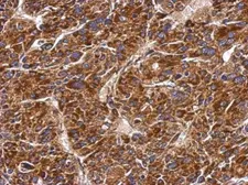 Anti-MMAB antibody used in IHC (Paraffin sections) (IHC-P). GTX106767