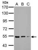 Anti-KBTBD4 antibody used in Western Blot (WB). GTX106777