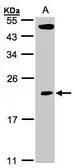 Anti-TPRKB antibody used in Western Blot (WB). GTX106781