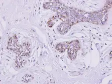 Anti-SLC25A33 antibody [N3C3] used in IHC (Paraffin sections) (IHC-P). GTX106785