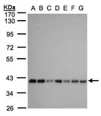 Anti-SLC25A33 antibody [N3C3] used in Western Blot (WB). GTX106785