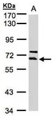 Anti-THUMPD3 antibody [N1N3] used in Western Blot (WB). GTX106796