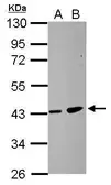 Anti-ZDHHC11 antibody used in Western Blot (WB). GTX106800
