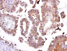 Anti-TATDN1 antibody [N1C2] used in IHC (Paraffin sections) (IHC-P). GTX106818