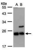 Anti-CBFb antibody [N1C3] used in Western Blot (WB). GTX106820