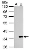 Anti-Galectin 8 antibody used in Western Blot (WB). GTX106821