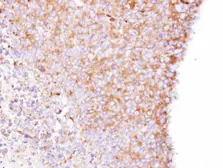 Anti-Coronin 1B antibody [N1N3] used in IHC (Paraffin sections) (IHC-P). GTX106831