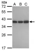 Anti-CAPZA1 antibody [N2C3] used in Western Blot (WB). GTX106832