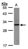 Anti-ANKRD7 antibody [N1C3] used in Western Blot (WB). GTX106843