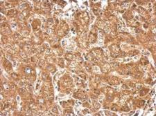 Anti-HACL1 antibody used in IHC (Paraffin sections) (IHC-P). GTX106858
