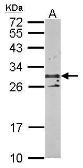 Anti-TSPAN3 antibody used in Western Blot (WB). GTX106868