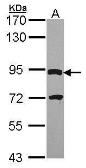 Anti-DPY19L4 antibody [C2C3], C-term used in Western Blot (WB). GTX106885