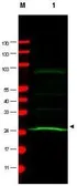 Anti-MAD2L1 antibody [17D10] used in Western Blot (WB). GTX10691