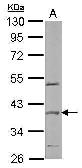 Anti-SPOP antibody [N1C1] used in Western Blot (WB). GTX106942