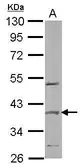 Anti-SPOP antibody [N1C1] used in Western Blot (WB). GTX106942