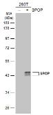 Anti-SPOP antibody [N1C1] used in Western Blot (WB). GTX106942